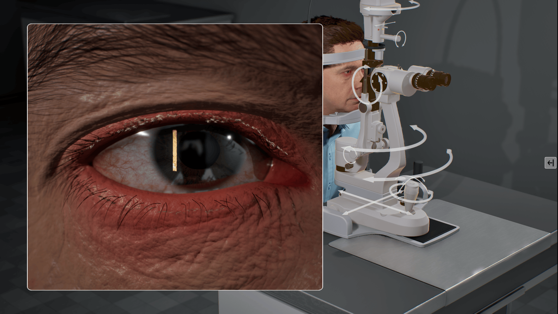 Slit Lamp Simulation-1gdxv