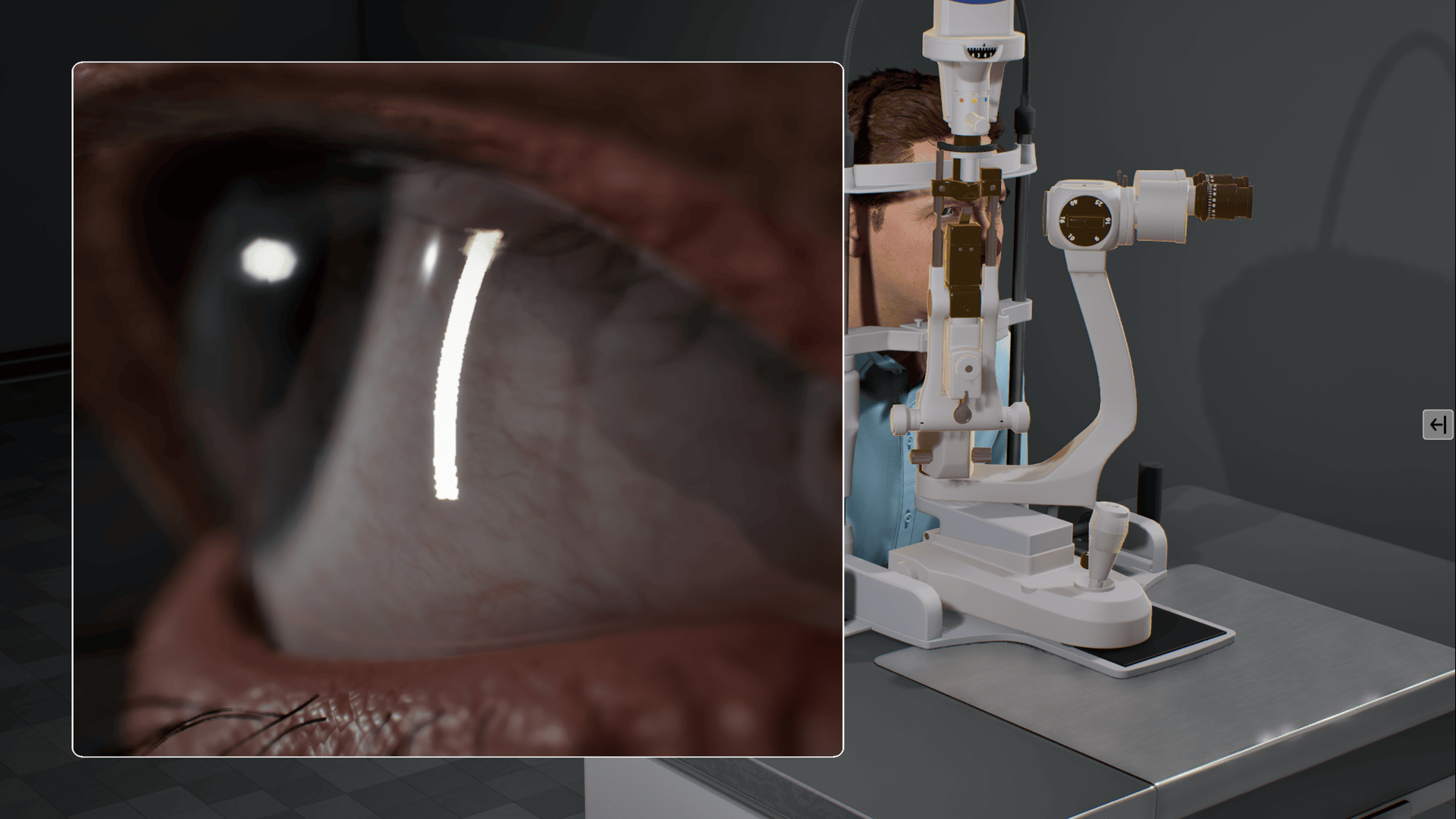Slit Lamp Simulation-1tcmy