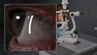 ModnyVR : Slit Lamp Simulator screenshot 3