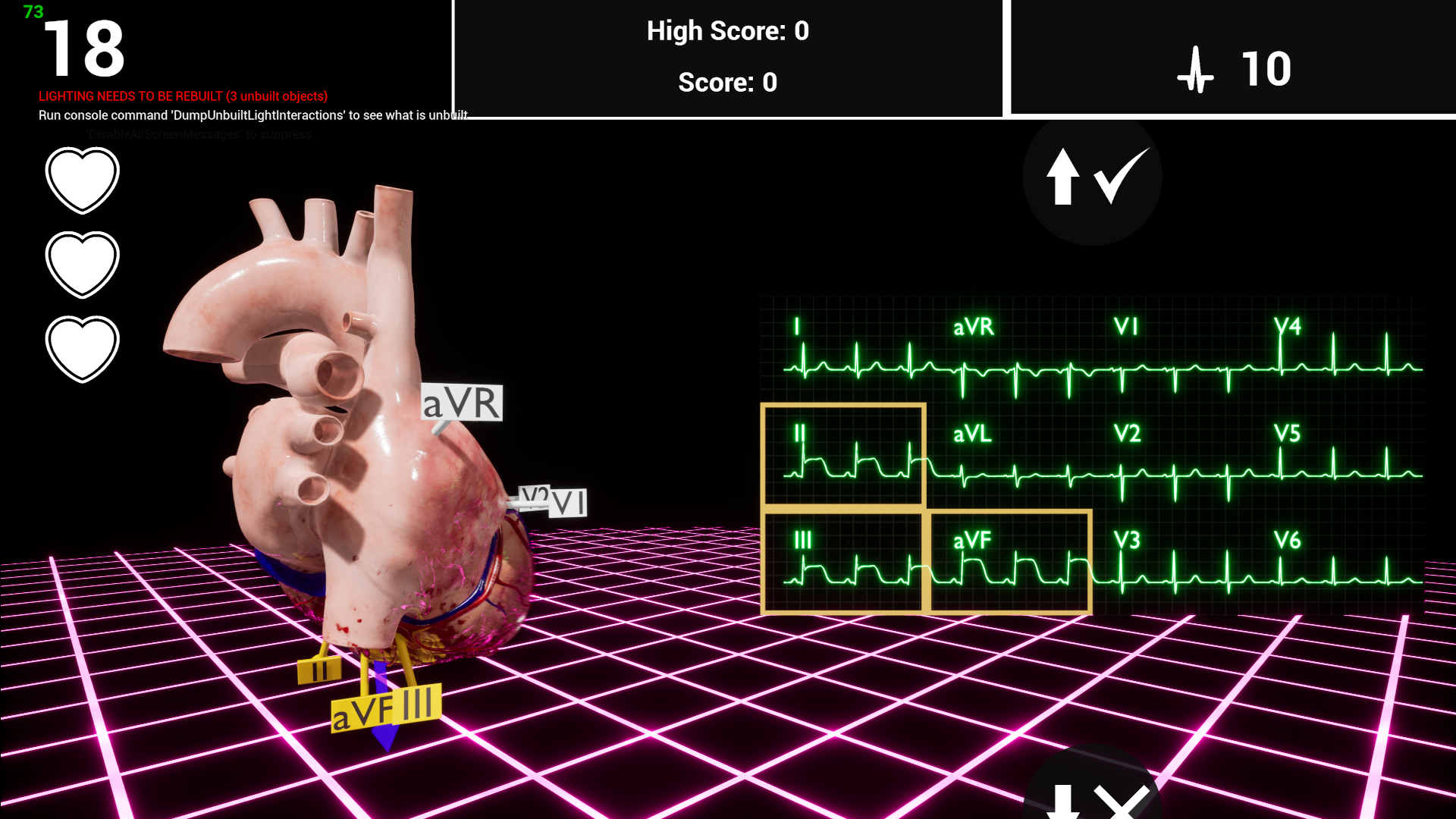 ER-cade-10wbv