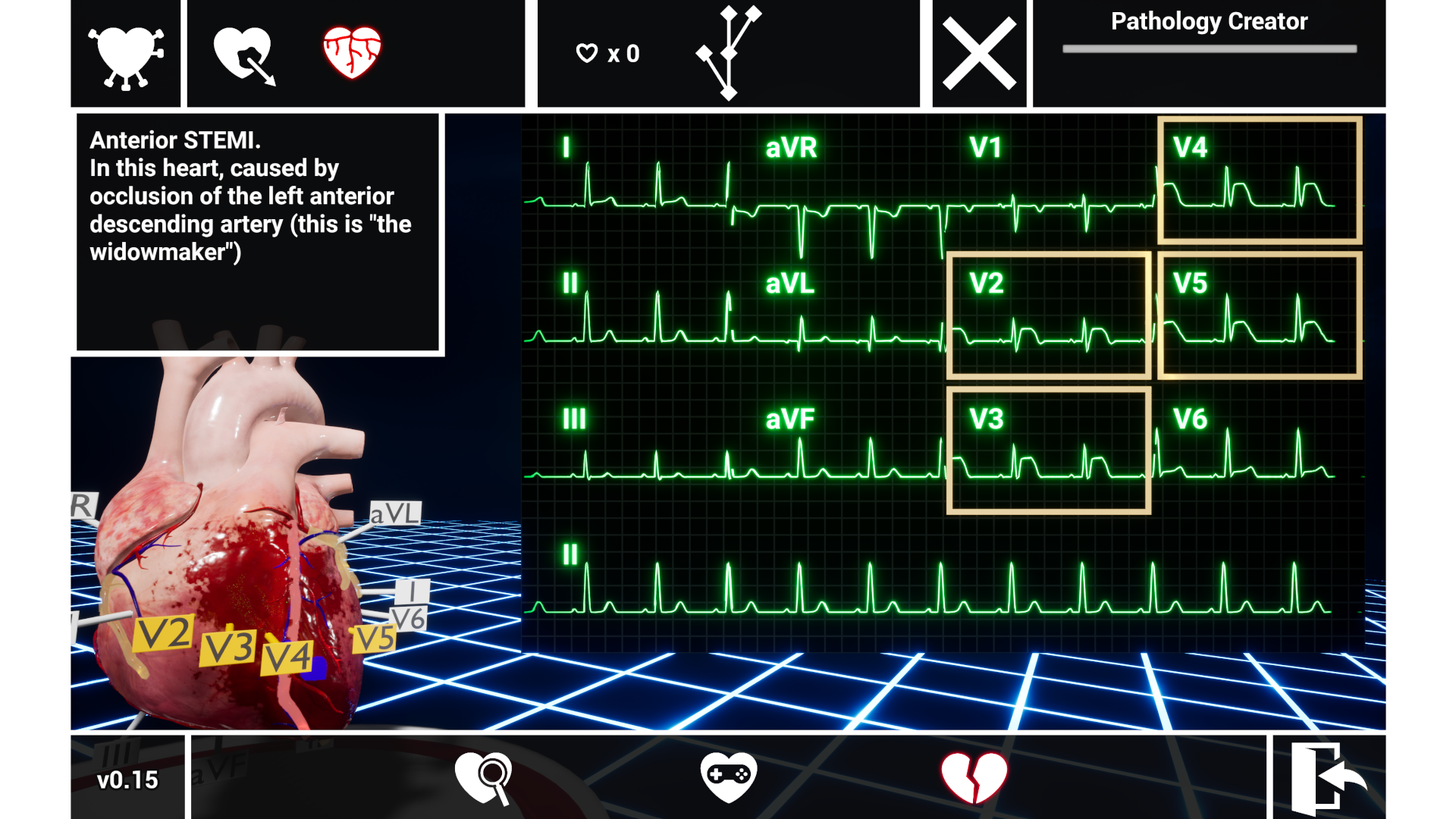 ER-cade-qkr3i