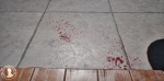 Animated Blood Ground Decal Vol.I - Snapshot